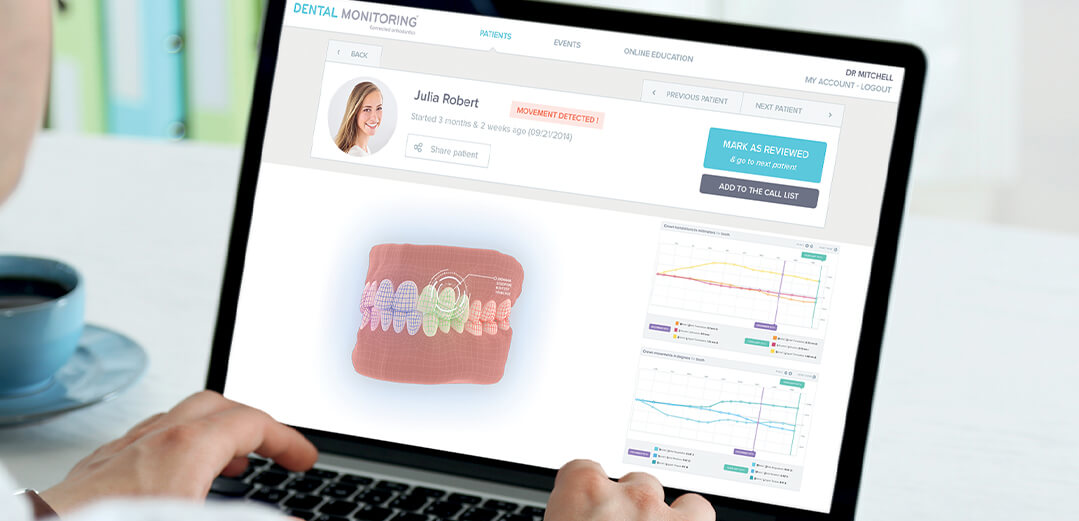 Dental Monitoring: How It Works?