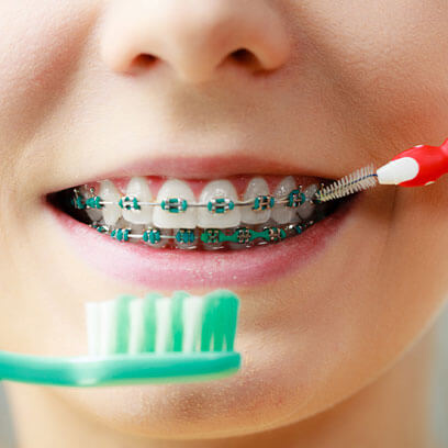 Caring for your braces